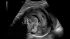 GE Healthcare Voluson E10