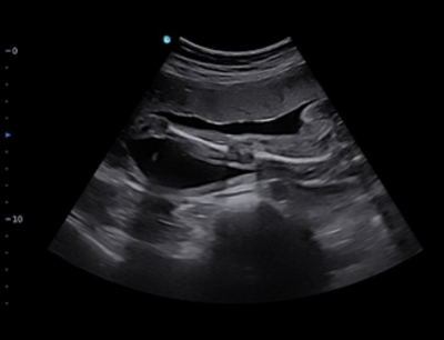 Chison SonoTouch 50 (SonoAir)