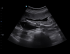 Chison SonoTouch 50 (SonoAir)